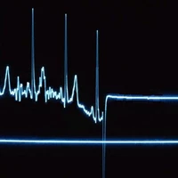 flatline