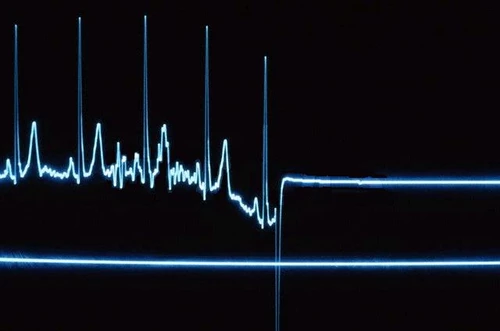 flatline